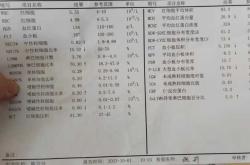 婴儿发烧会嗜睡吗