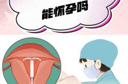 摘环后多久可以成功怀孕