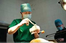 剖腹产机器缝合好吗