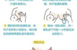 产后胀奶痛如何缓解