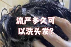 剖宫产后多久可以洗头