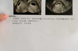 孕5周突然孕反消失正常吗