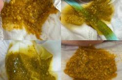 婴儿奶瓣大便图什么样