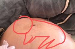 刚满39周可以剖腹产吗