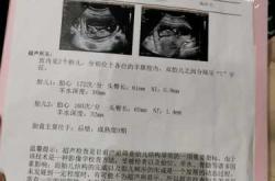 彩超做多影响备孕吗