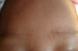 婴儿几个月开始长眉毛