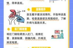 顺产肛门坠胀多久消失