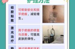 剖腹产伤口黏黏的是怎么回事