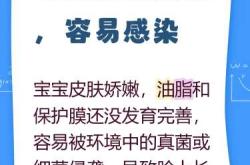 婴儿脸上长癣图片是什么样的