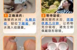 婴儿怎么滴眼药水