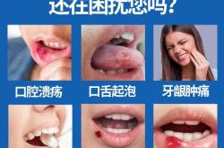 新生儿嘴巴起泡是怎么回事