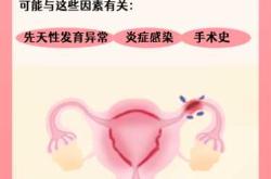 输卵管一侧堵塞还能怀孕吗