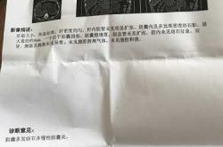 查过敏源影响备孕吗