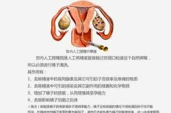 做试管婴儿的地方在哪里