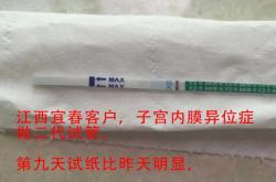 有没有做试管婴儿成功实例