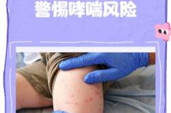 婴儿脸部过敏怎么办