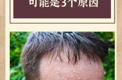 婴儿盗汗是什么原因引起的