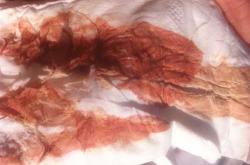 产后十天大便小腹坠痛正常吗