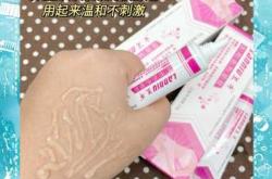 产后妊娠纹会自然消失吗