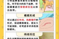 剖腹产如何取出宝宝