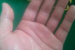 产后手心出汗是怎么回事