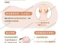 备孕同房十三天后乳房痛怎么回事