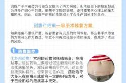 谈固医院剖腹产有啥注意事项