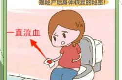 产后同房出血要紧吗