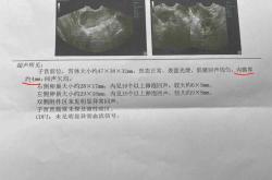 内膜12厚度能否成功怀孕