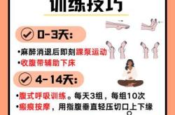 剖腹产一年后怀孕能要吗