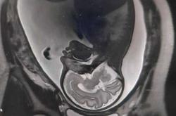 花茵美备孕安全吗