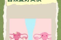 引产后多久可以穿短裤