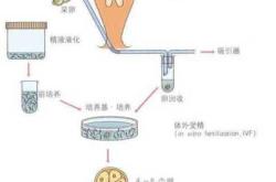 二代试管婴儿费用是多少