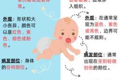 新生儿有红胎记咋办