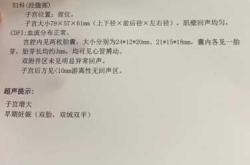 孕10周孕反是否严重