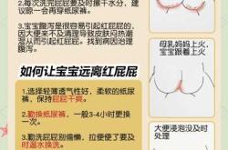 新生儿屁股有个坑是怎么回事