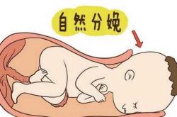 马伊俐顺产还是剖腹产