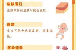 新生儿身上起红疙瘩咋回事