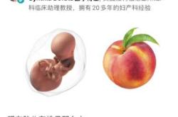 孕14周引产后需休息多久