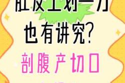 剖腹产多久刀口才不疼