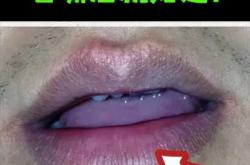 新生儿嘴唇发紫咋回事