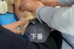 顺产后下腹痛是怎么回事