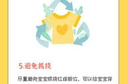 婴儿过敏疹怎么办