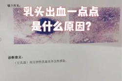 流产后乳头溢水正常吗