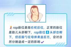 胎位不正能顺产吗