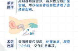 剖腹产打不打麻药