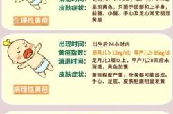 新生儿按时喂养还是按需喂养