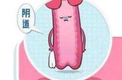 女性产后阴道会有哪些变化