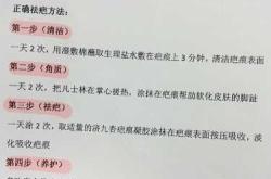 剖腹产能忌姜吗有啥需注意
