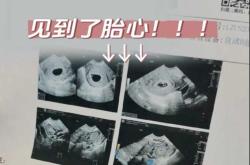 7周后孕反减轻正常吗